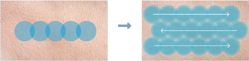 intellitrak technology