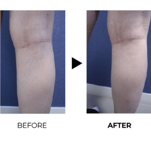 juvelook before after 2