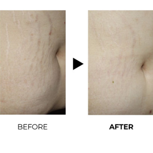 juvelook before after 3
