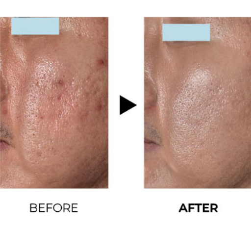 juvelook before after 4