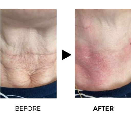 juvelook before after 5
