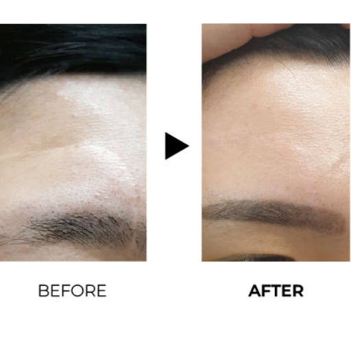 juvelook before after 6
