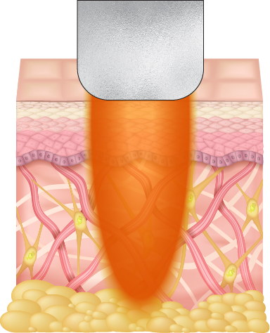 soprano titanium stack mode