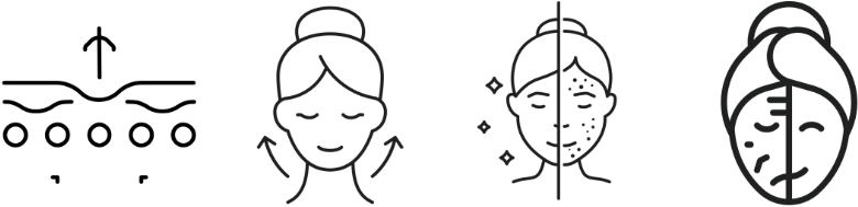 Thermage FLX Benefits 