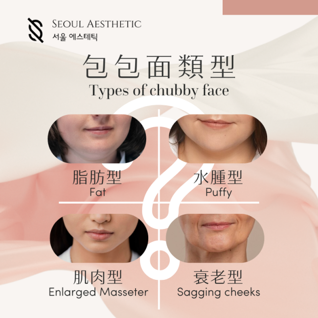 types of chubby faces