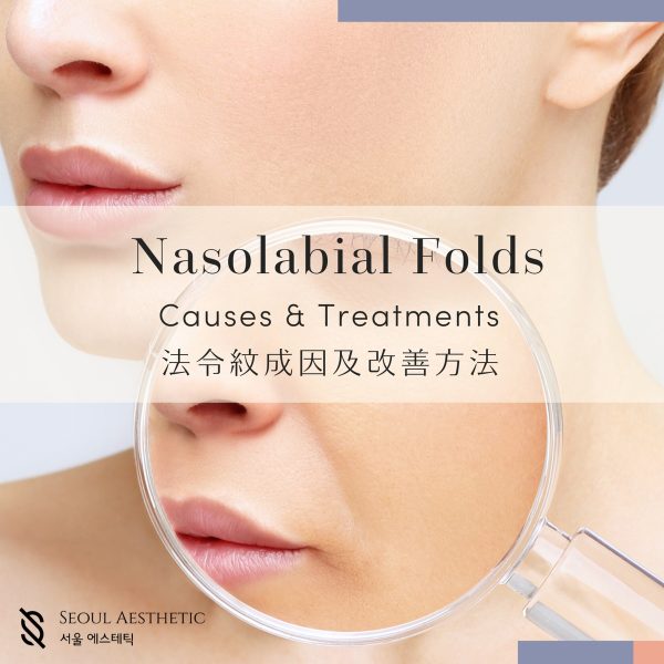 nasolabial folds causes and treatments